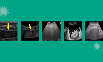 A New Mode to Diagnose Pneumo(Peritoneum)